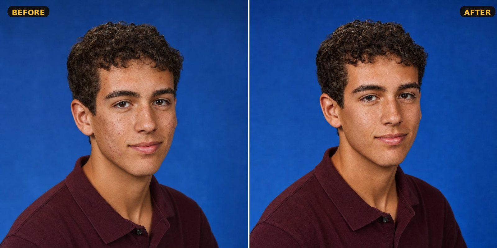 Retouch Rush — senior portrait with acne smoothed, before and after